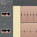Tipps + Tricks: Logic Zone – Timingkorrektur von Audioaufnahmen (Teil 2 von 2)